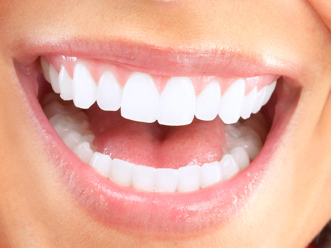 Ways how the celebrities get whiter teeth health insurance in Georgia