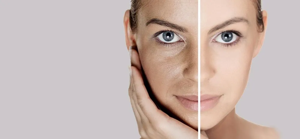 Sagging skin tightening
