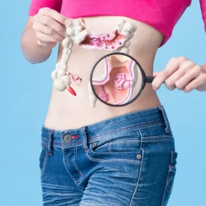 colon cancer